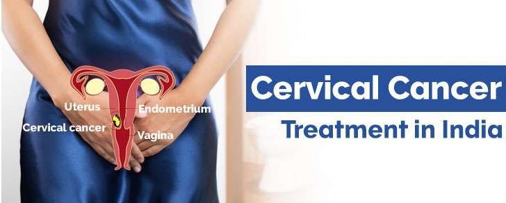 Cervical Cancer Treatment in India